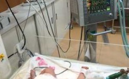 新生儿为什么上呼吸机,新生儿为什么呼吸机辅助呼吸 