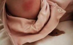  一岁宝宝打疫苗「一岁宝宝打疫苗的地方有硬块」