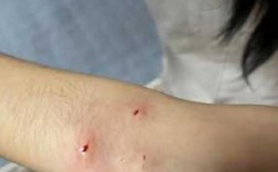  打疫苗的家猫抓伤「打了疫苗的家猫抓出血」