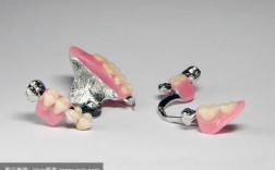 什么是定制式义齿牙套