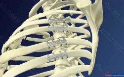取肋骨接骨板的器械叫什么,取肋骨手术怎么做 