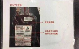 输血袋有什么规格_输血血袋标签图解