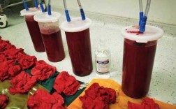检验装血的容器叫什么名称-检验装血的容器叫什么