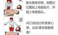 什么是带除颤功能的AED,除颤器aed什么情况下使用 