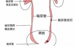 输尿管导管是什么意思 输尿管导管是什么
