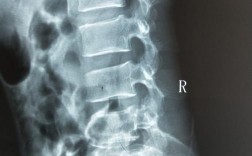 脊椎有问题拍什么片子-脊椎病拍啥片效果好