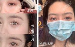 上海哪个医院做双眼皮好看 上海那医院做双眼皮效果好