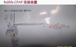  CPAP主要用于什么病人「cpap是指什么」