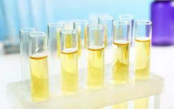 尿常规检查实验原理-尿常规检测试剂是什么原因
