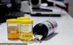 尿常规测什么的-尿常规检验用什么试剂