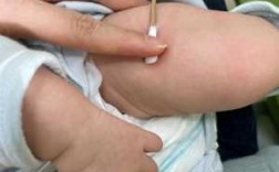 婴儿打疫苗打腿上是什么情况 为什么婴儿疫苗打大腿