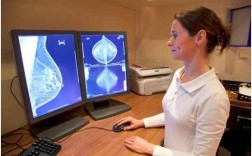 乳腺数字平板检查是什么-做乳腺平板是什么情况