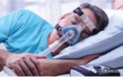  为什么睡觉要用呼吸机「睡觉用呼吸机 还打呼噜吗」