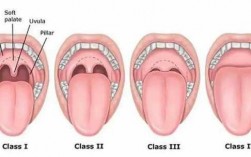 口咽气道三种规格是什么,口咽气道三种规格是什么 