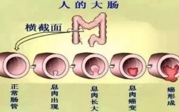 透视和肠镜哪个效果好,透视肠道 
