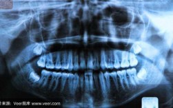 牙科照x光对身体好不好-牙科x光是什么样的