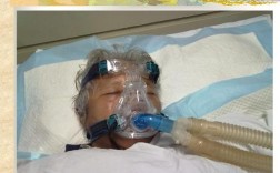哪些患者禁用呼吸机 什么病人禁止呼吸机