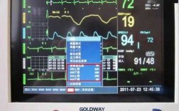  心电监护仪器数字代表什么「心电监护仪数字指标代表啥」