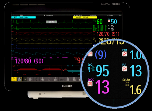  监护仪低灌注是什么意思「心电监护仪 灌注指数」-图3