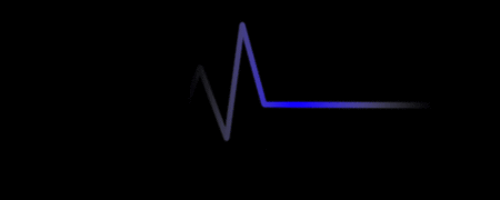 动态心电图上e代表什么,动态心电图ch1+ -图3