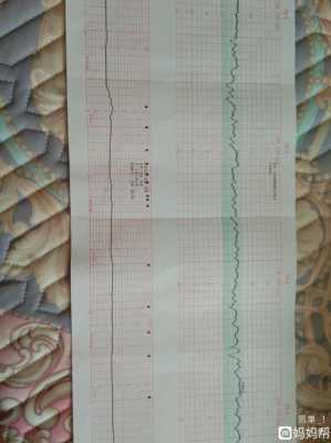 胎心监测上的FM为0什么意思（胎心监护上fm是什么意思）-图2