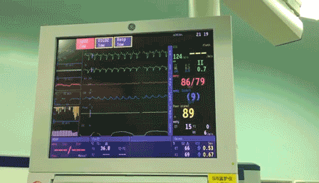 动态心电监护仪一般适用于以下疾病的诊断-动态心电监护仪叫什么-图2