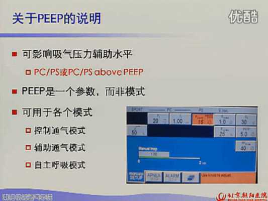  cpap参数peep是什么「cpap模式下有哪些参数」-图1
