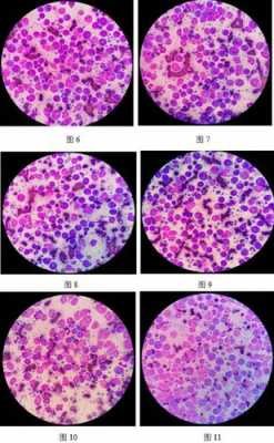 淋巴细胞中除了bt外还有什么_淋巴中的细胞种类-图3