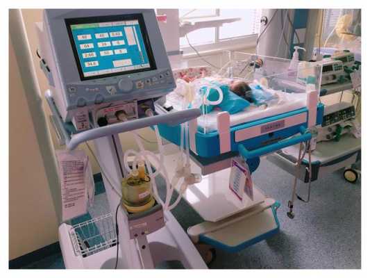 新生儿呼吸机什么品牌好用-新生儿呼吸机什么品牌好-图1