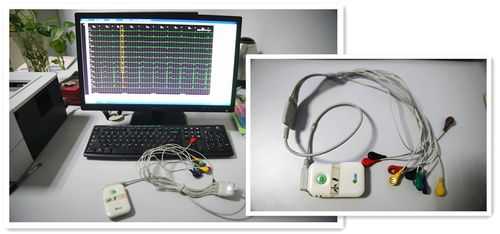  心电图的设备有什么组成「心电图的设备叫什么」-图2