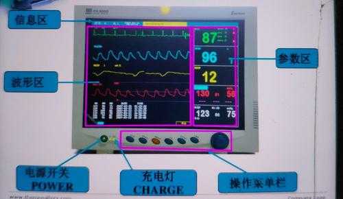 心电监护仪用途及说明-图1