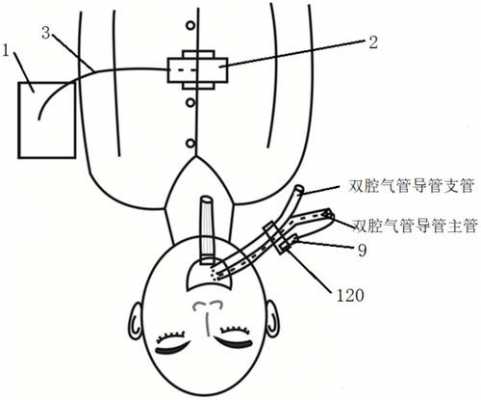 双腔气管插管是什么,双腔气管插管的原理图 -图3