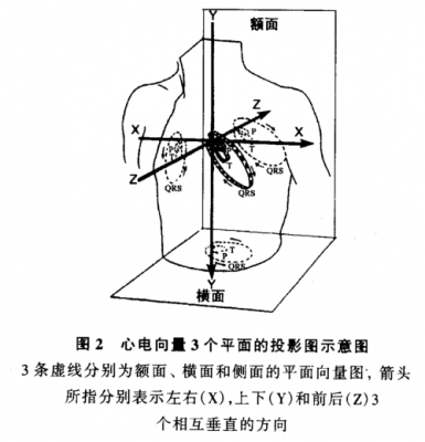 心电图的传导系统及顺序 心电图传导无线图什么名字-图3