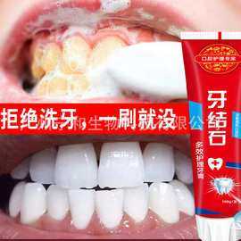 哪个牙膏去牙结石-那种牙膏去牙结石效果好-图3
