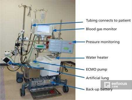 人工心肺机有什么分类和作用-图2