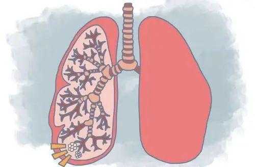 肺aah是什么-肺As是什么-图3