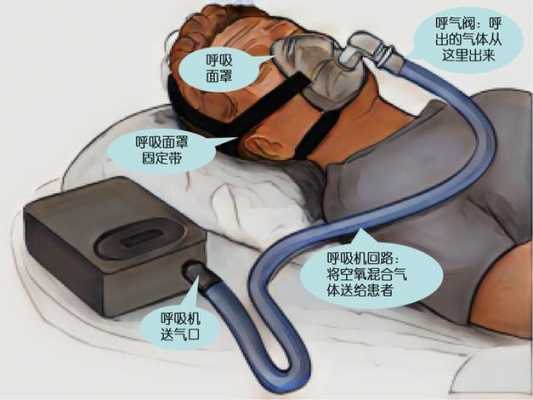 肺炎肺感染一般插呼吸机多久-肺炎带家用呼吸机注意什么-图3