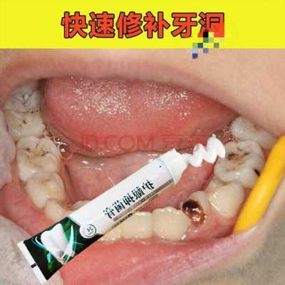 什么牙膏治疗蛀牙效果好,什么牙膏治疗蛀牙最有效 -图3