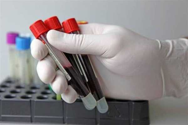 血检特定蛋白是检查什么,抽血特定蛋白是检查什么 -图1