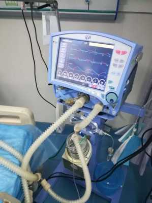 病人什么时候可以摘掉呼吸机-什么时候可以取下呼吸机-图2