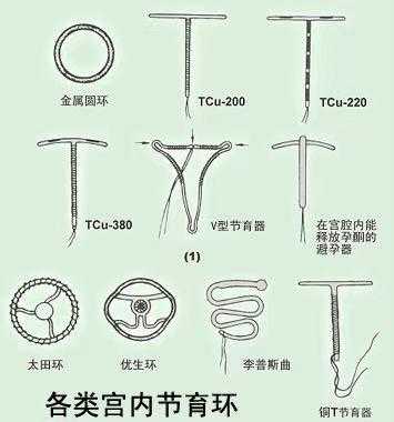 宫内节育环是什么材质-天一宫内节育环是什么形状-图3