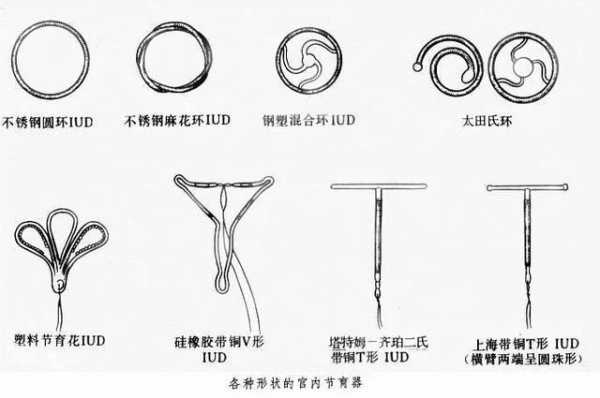 宫内节育环是什么材质-天一宫内节育环是什么形状-图2
