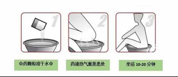 肛门熏洗的作用-肛周熏洗是什么意思-图3