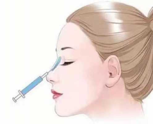 哪种隆鼻方法安全又永久 什么隆鼻方法便宜效果好-图3