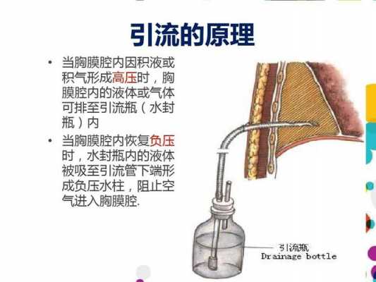  胸腔引流管引得是什么「胸腔引流管的作用」-图3