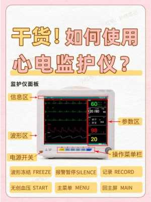 心电监护仪有什么作用,心电监护仪有什么作用和用途 -图1