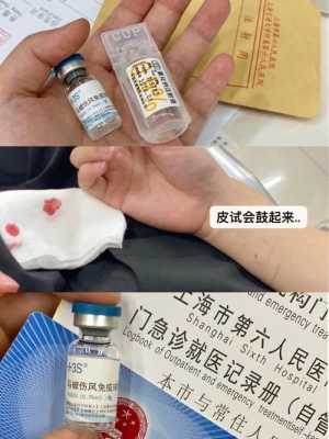 徐州破伤风针疫苗_扬州打破伤风多少钱-图3