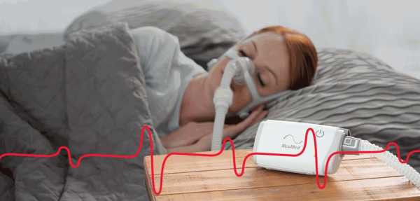 呼吸机压力支持是什么-图3