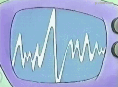 动态心电图干嘛的 动态心电图机又叫什么-图2
