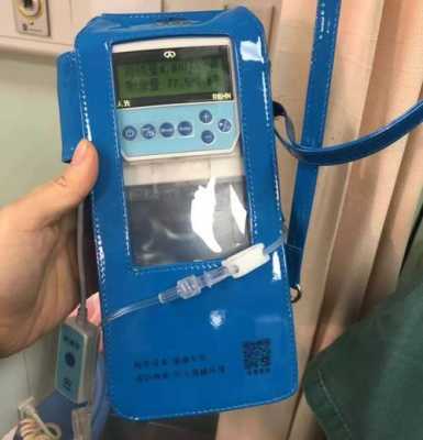 电子止痛泵在医院怎么收费的 电子止痛泵有什么作用-图2